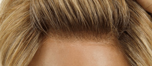 Lace-front hairline